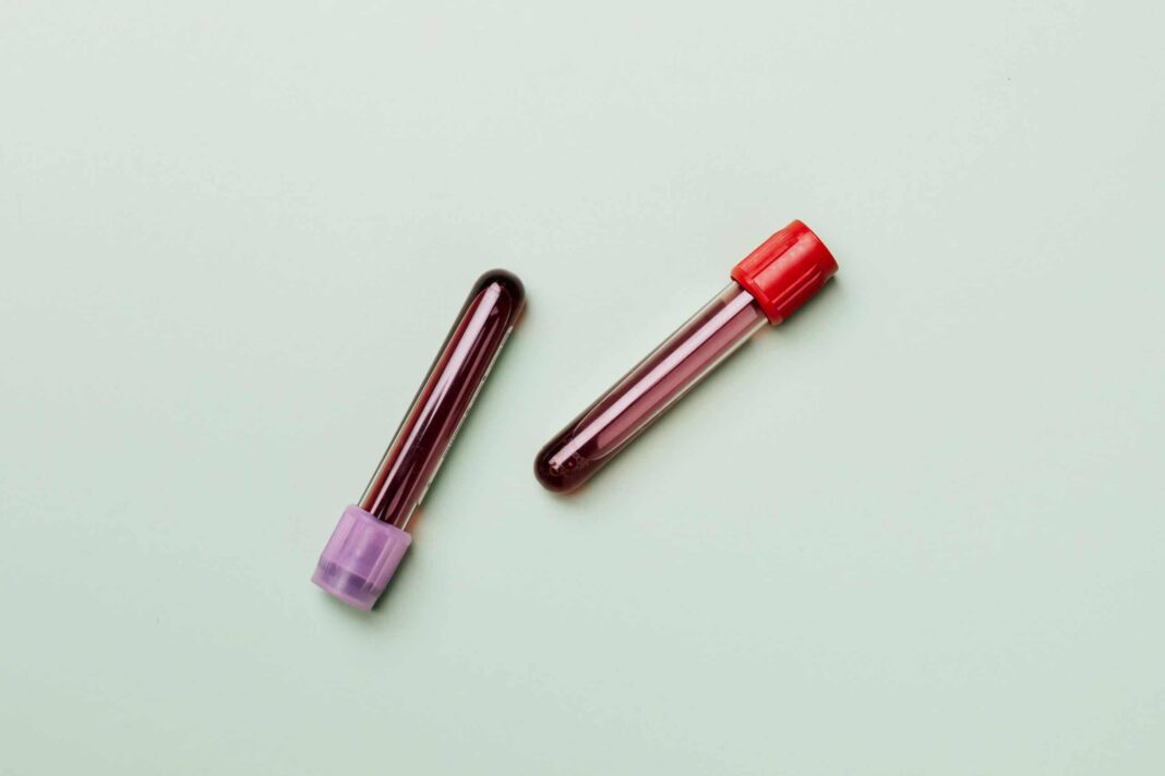 Cientistas recriam sangue humano em laboratório