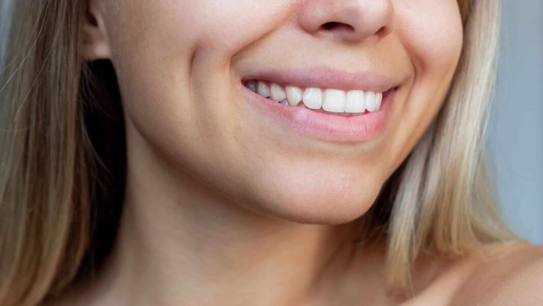 Gel revolucionário é capaz de reverter a erosão do esmalte dentário