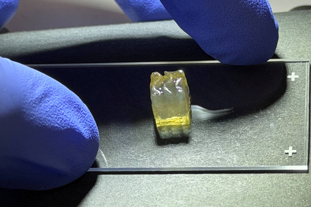 Mão com luva azul segura pinça que segura uma peça dentária amarelada sobre superfície escura.